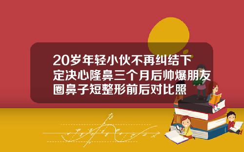 20岁年轻小伙不再纠结下定决心隆鼻三个月后帅爆朋友圈鼻子短整形前后对比照