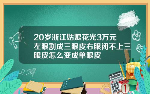 20岁浙江姑娘花光3万元左眼割成三眼皮右眼闭不上三眼皮怎么变成单眼皮